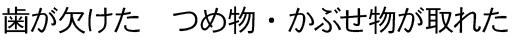 歯が欠けた　つめ物・かぶせ物が取れた
