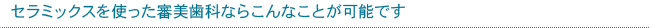 セラミックスを使った審美歯科ならこんなことが可能です