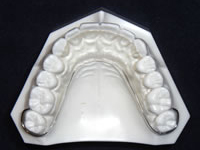 阿部歯科で使用している改良アムステルダム型スプリント