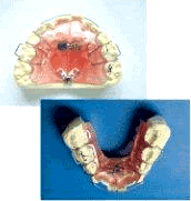 阿部歯科クリニックの矯正歯科治療